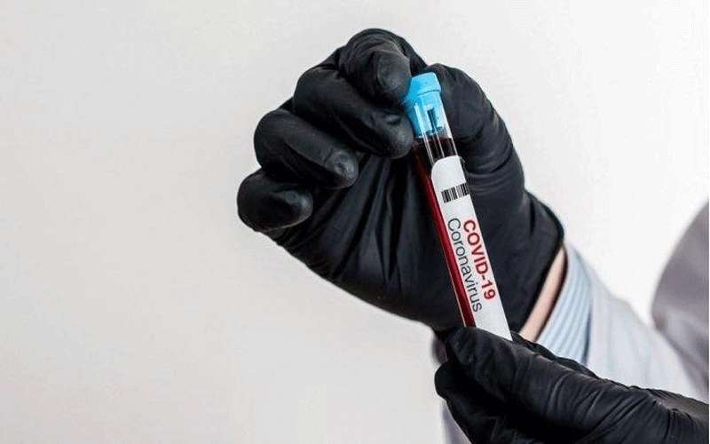 5021 فحص كورونا للسائقين على العمري