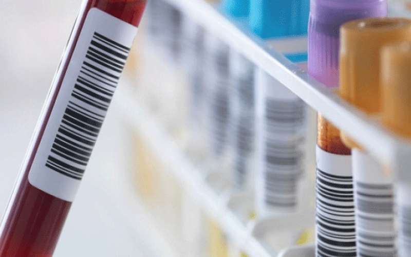 سحب 2100 عينة لفحص كورونا من