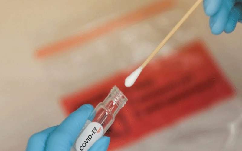 90 عينة سلبية لمخالطي مصابة في