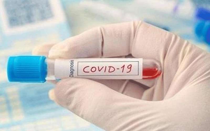 مدير صحة البلقاء: 70 عينة سلبية