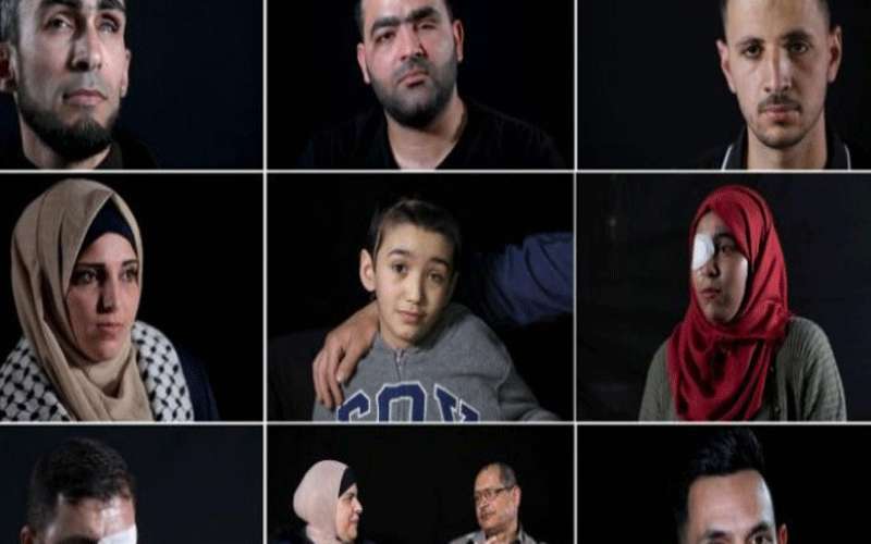 فقدوا عينا خلال مواجهات مع الاحتلال..