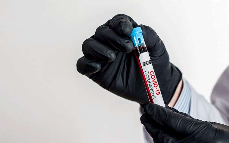 أخذ أكثر من 20 ألف عينة