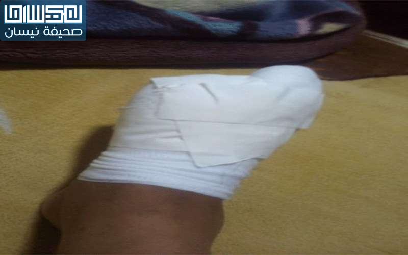 اربد: طبيب بيطري عالج مريض بالأسيد