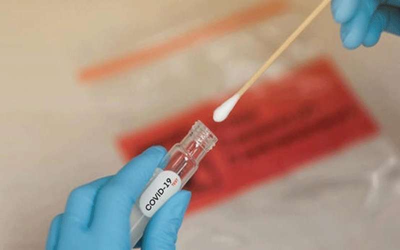 جمع عشرات العينات من مخالطي مصاب
