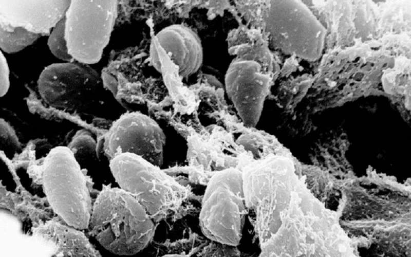 الطاعون الدبلي يطرق باب أميركا