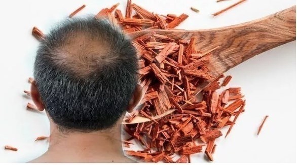 اكتشاف مادة كيميائية تحفز نمو الشعر