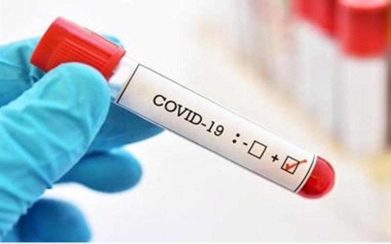 جميع عينات المخالطين في جرش سلبية