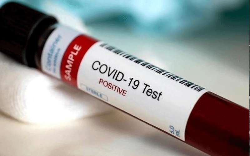 الاردن يسجل وفاة جديدة بفيروس كورونا