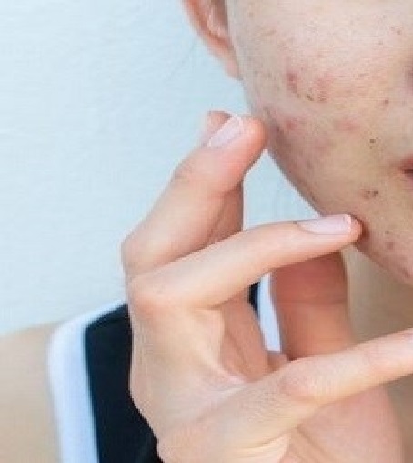 ربع النساء يستخدمن فلاتر الصور لإخفاء