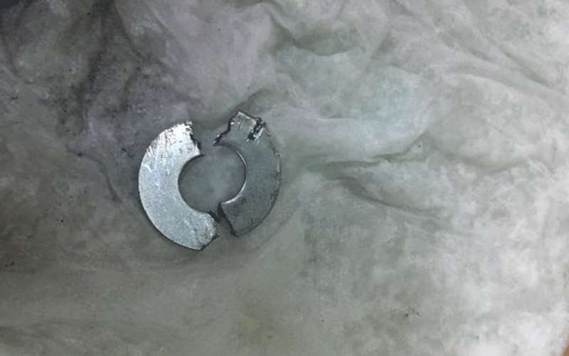 الدفاع المدني يحرر اصبع طفل علق