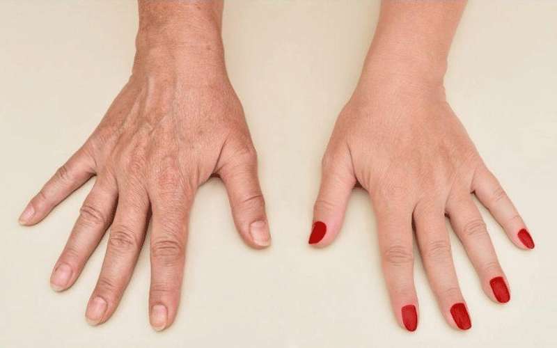 سيدتي اليك .. أفضل الطرق لشد