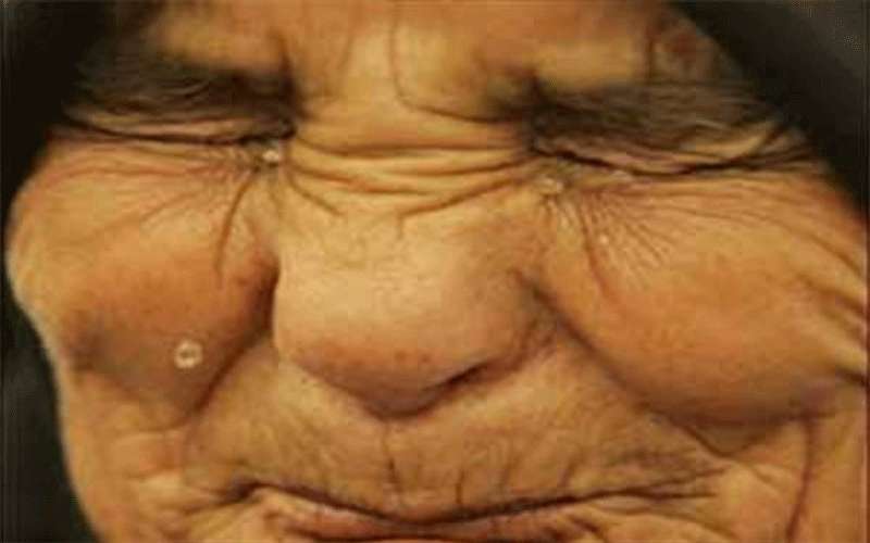 اغتصاب مسنة عمرها 98 عاما في