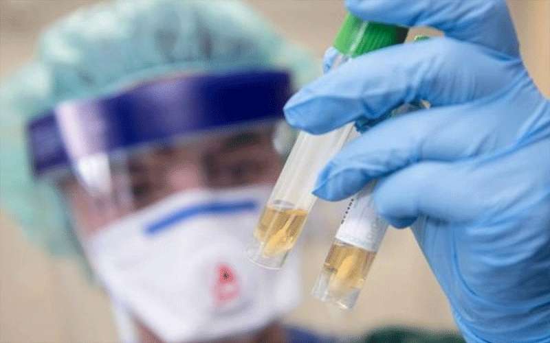 إصابة جديدة بفيروس كورونا في مأدبا