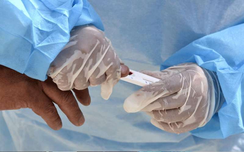 إجمالي إصابات كورونا بالكرك 49