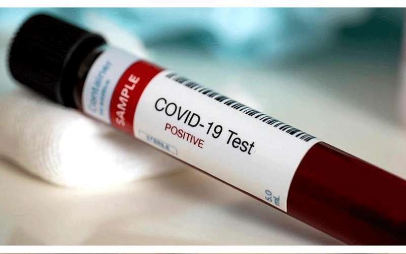 عزل منزلين بقضاء العارضة