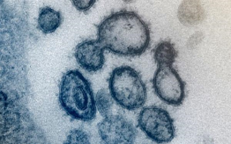 دراسة: كورونا قد يبقى بالمعدة وينتقل