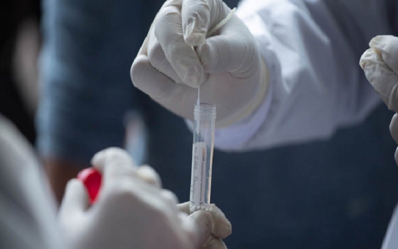 الرمثا: نتائج سلبية ل 27 عينة