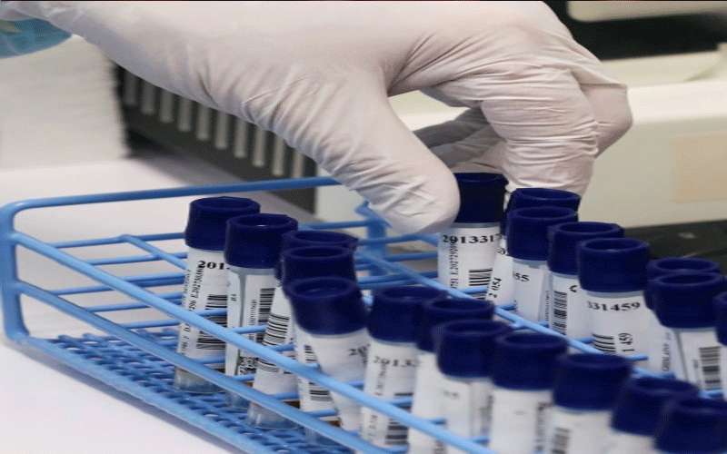 إصابتان بكورونا في مأدبا