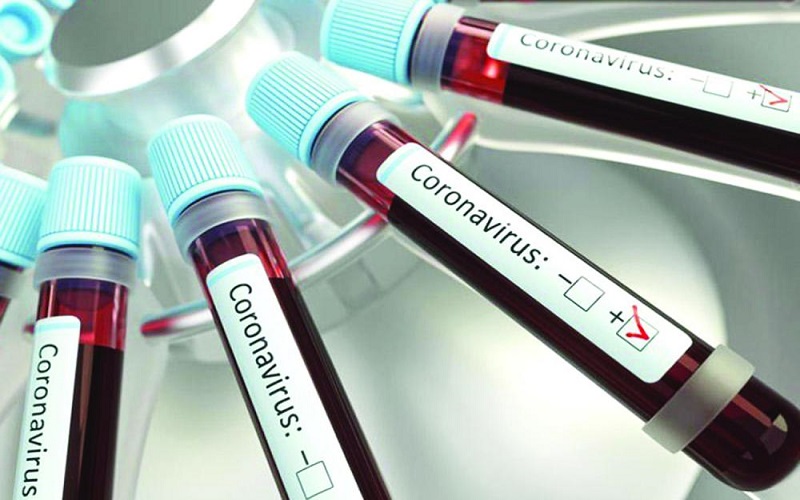 اصابة كورونا جديدة في مادبا