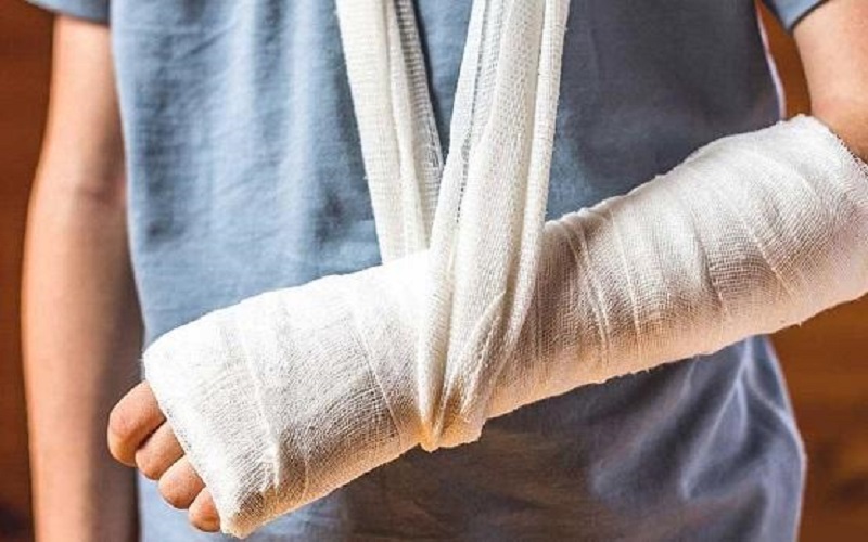 ابتكار ضمادة تصلح العظام المكسورة