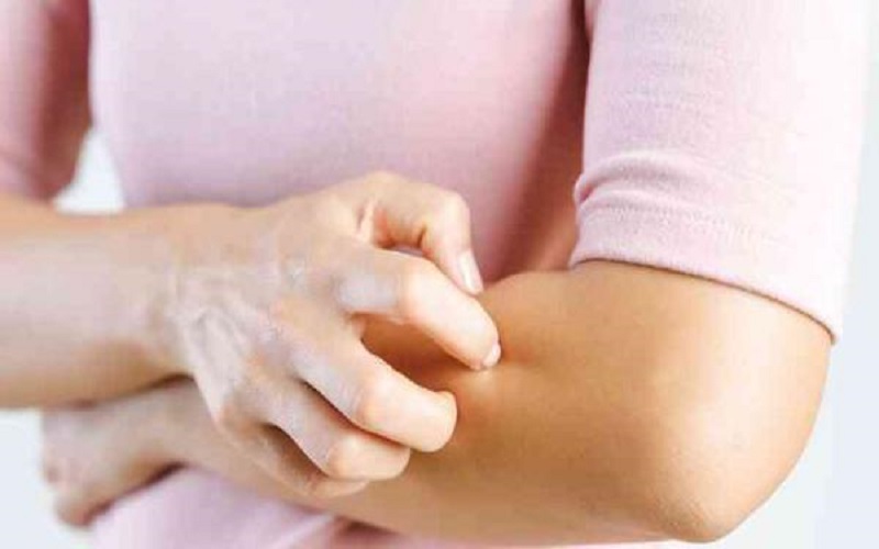 علامة جديدة مرتبطة بكورونا تستمر أسابيع