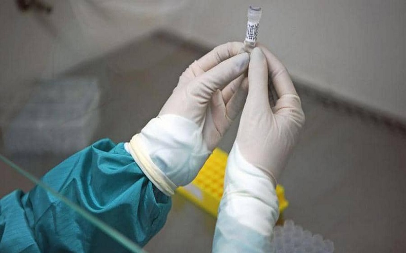 علماء يكتشفون سر تفاوت شدة كورونا