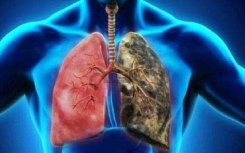 طرق بسيطة تحافظ على الرئتين قوية