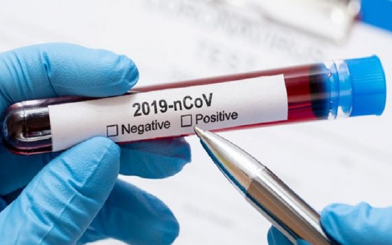 تسجيل 29 وفاة و2648 اصابة جديدة