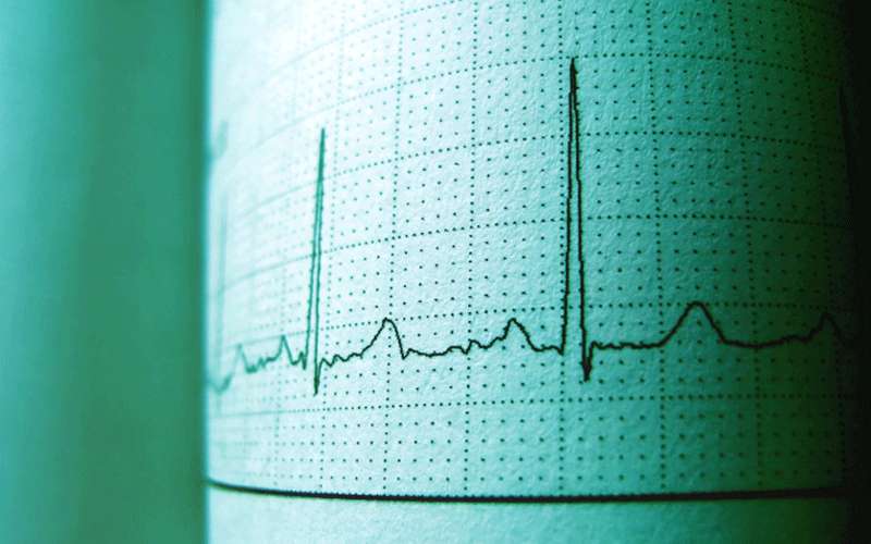 النوبة القلبية: أربعة مسببات لتشنج الشريان