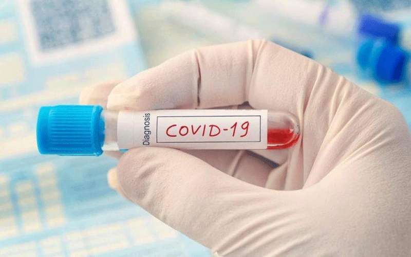 وفاة رابعة بفيروس كورونا في العقبة