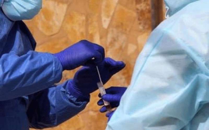 %17.3 نسبة فحوصات كورونا الايجابية الاثنين