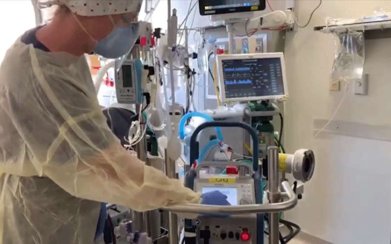 ما قصة أجهزة ال ECMO ولماذا