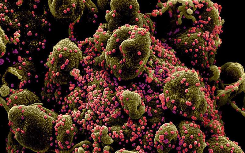 إصابات كورونا في العالم تتجاوز 54.59