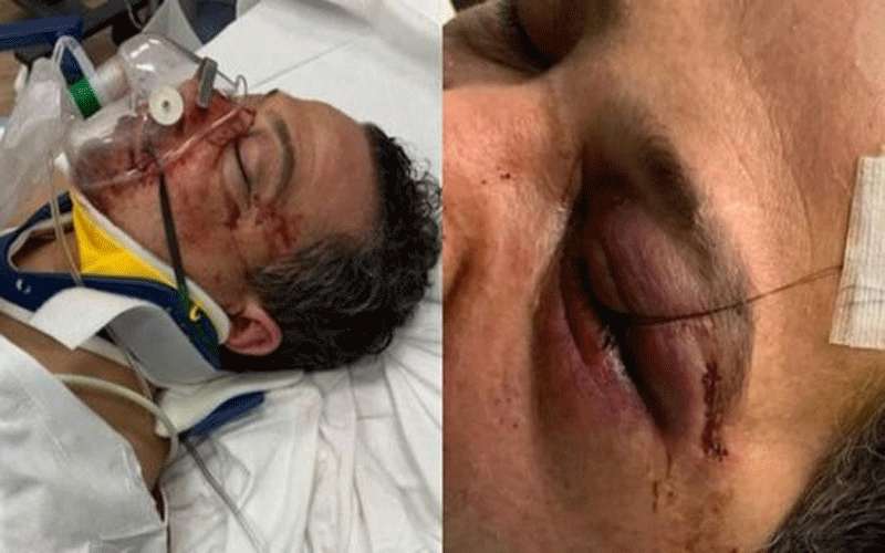 اعتقال امرأة بعد هجوم وحشي على