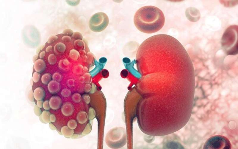 كل ما تريدون معرفته عن الفشل