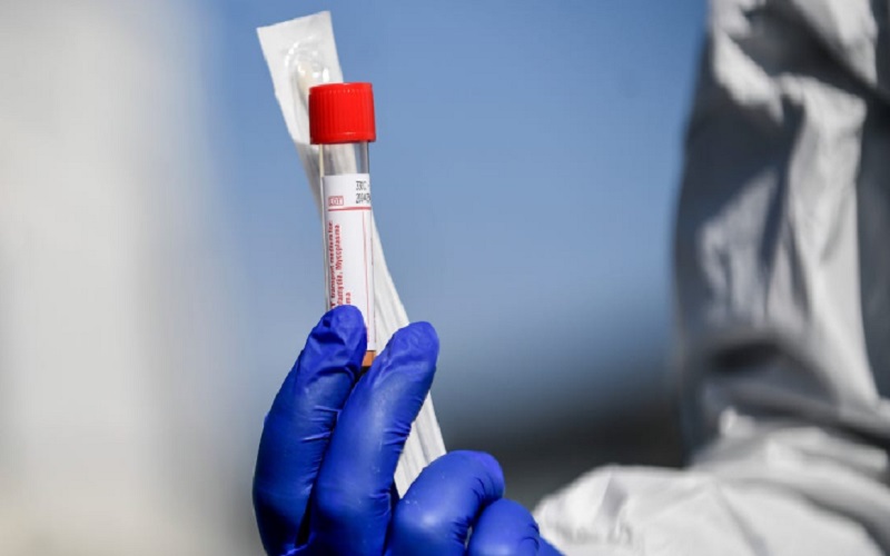 232 وفاة و16055 اصابة كورونا في