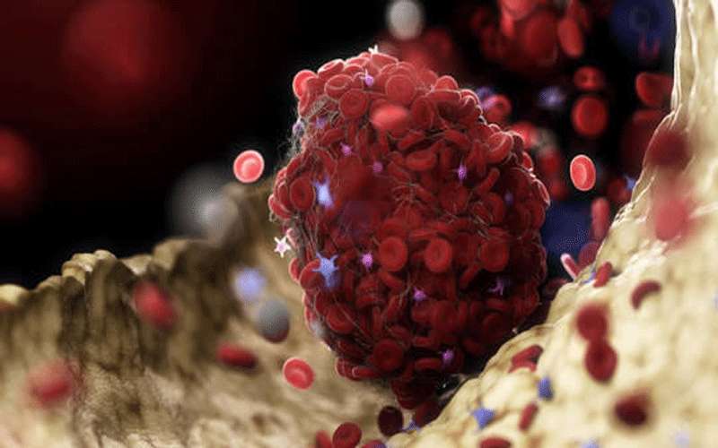 مادة فعالة تساعد بعلاج حالات كورونا