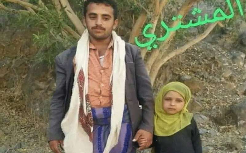 أب يمني يبيع طفلته بـ350 دولار