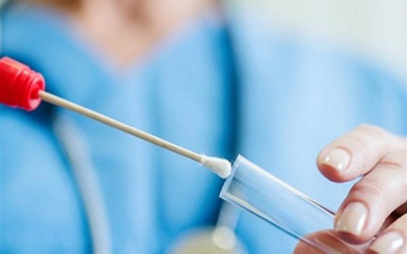 %3.51 نسبة فحوصات كورونا الايجابية الأربعاء