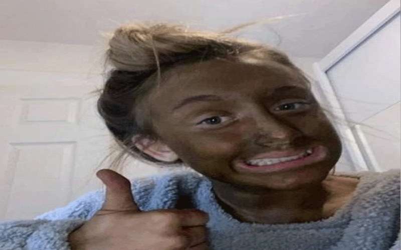 استخدمت مادة لتسمير البشرة.. فكانت النتيجة