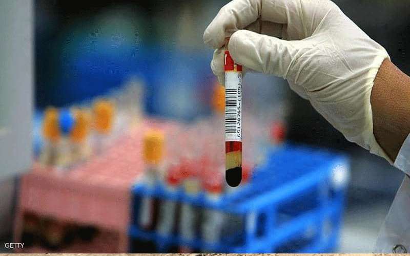 تخفيض سعر فحص الأجسام المضادة