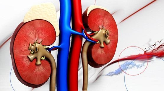 أطباء يحذرون من مرض شائع يصيب