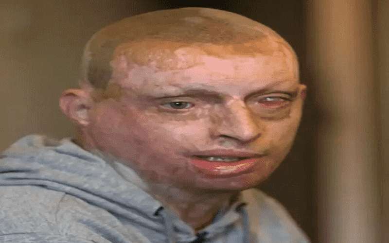 شاب يتحول إلى مسخ على يد