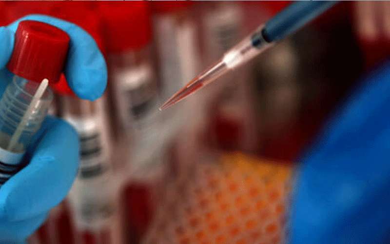 السلالة النيجيرية تنتشر في أميركا