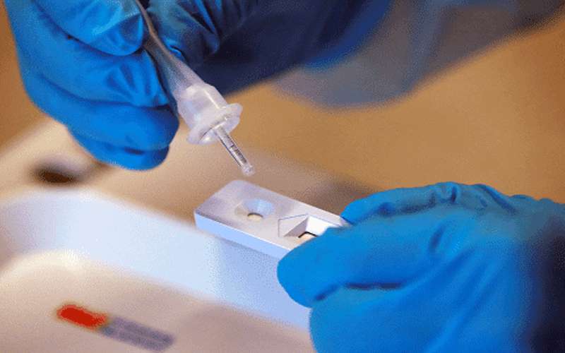 فائدة غير متوقعة لفيروس كورونا