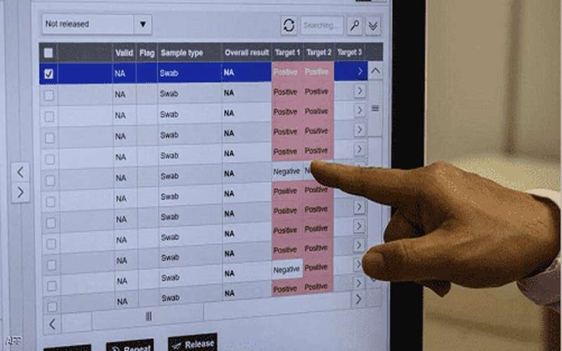 السلالة الفرنسية مضللة لفحوص كورونا