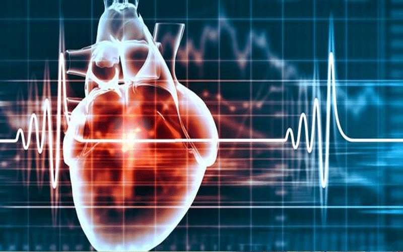 بتفكر بإجراء عملية قلب مفتوح بمناسبة