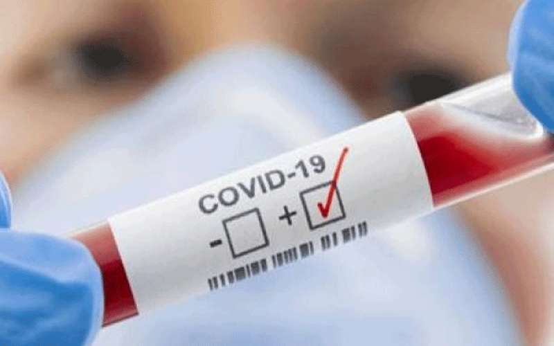 %18.96 نسبة فحوصات كورونا الايجابية الأربعاء