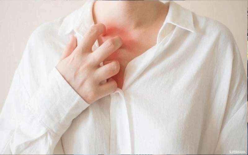 أبرز أمراض الصيف شيوعا والتي تصيب