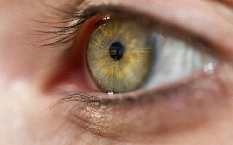 الأردنيون يتبرعون بـ 2932 قرنية خلال